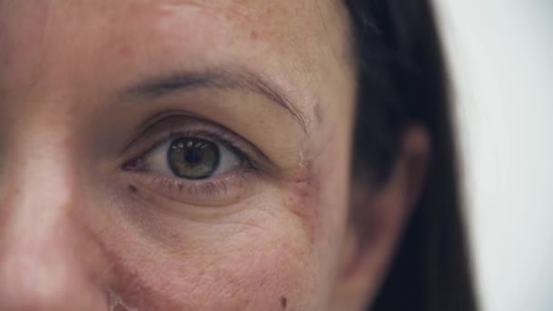 4k遅いです動きクロップビデオの女性の目と悪い肌. — ストック動画