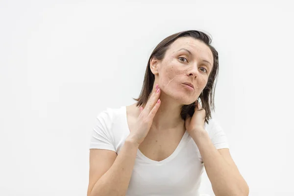 Photo of woman with dry skin touching her face on white background. — Stock Photo, Image
