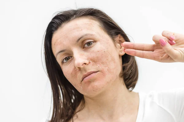 Close up photo of woman with dry skin over white background. — Stock Photo, Image