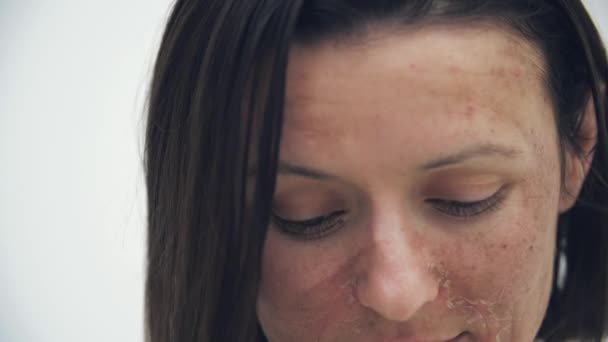 4k女性面部皮肤问题慢动作特写视频. — 图库视频影像