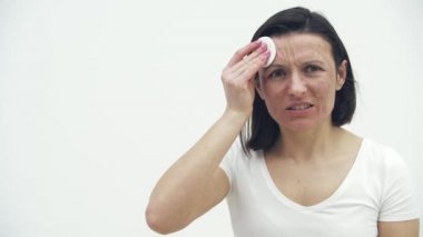 Yüzüne kozmetik süngerle dokunan kötü ciltli bir kadının 4K videosu..
