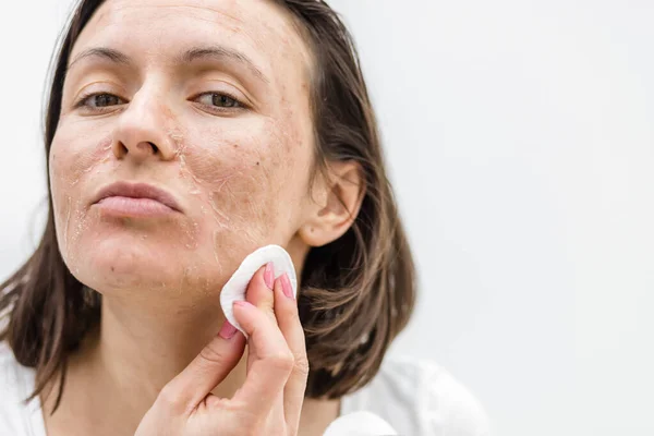 Close up photo of woman cleaning face with cosmetic sponge.