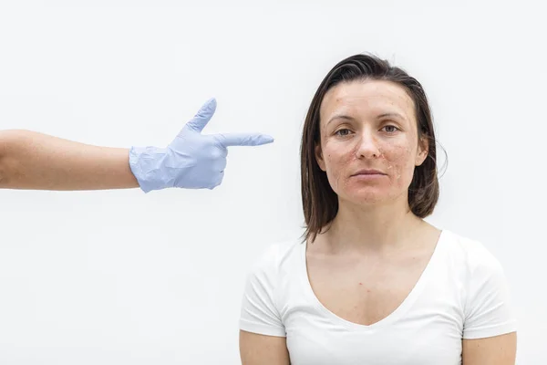 Närbild foto av kvinnligt ansikte och hand i medicinsk handske. Royaltyfria Stockbilder