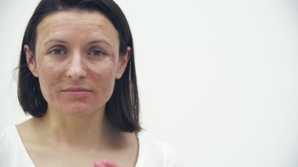 4k slowmotion close-up video van vrouwelijke gezicht met huidproblemen. — Stockvideo