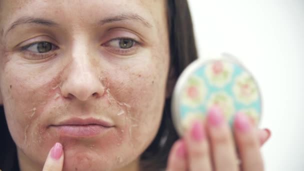 4k close up video of woman with dry skin. — Stock Video