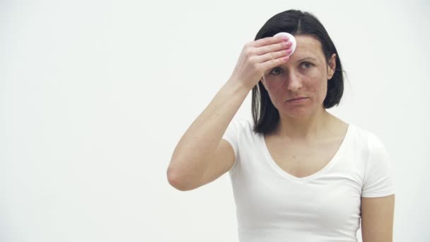 4k Zeitlupenvideo einer Frau mit schlechter Haut, die ihr Gesicht mit Kosmetikschwamm berührt. — Stockvideo