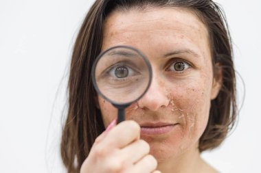 Cildi kuru bir kadının büyüteçten bakarken çekilmiş yakın bir fotoğrafı..