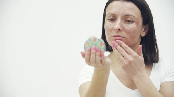 4k slow motion close-up video van vrouwelijke gezicht met huidproblemen op zoek naar de spiegel. — Stockvideo