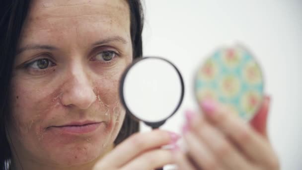 4k video of woman with bad skin looking through magnifying glass and holding mirror. — Stockvideo
