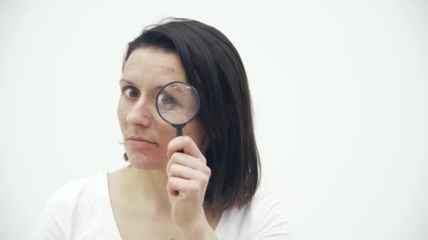 4k slow motion video of woman with bad skin looking through magnifying glass. — Video