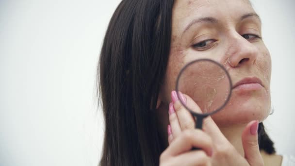 Slow Motion Video Woman Bad Skin Looking Magnifying Glass Concept — Vídeos de Stock