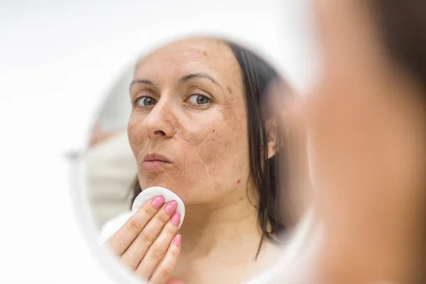 Fénykép Egy Nőről Akinek Bőrproblémái Vannak Miközben Tükörbe Néz Bőrápolás Stock Fotó