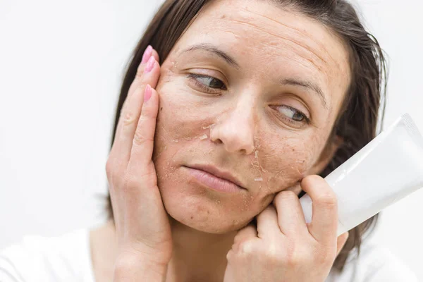 Cropped Photo Woman Dry Skin Holding Cream Face White Background — Stock Photo, Image
