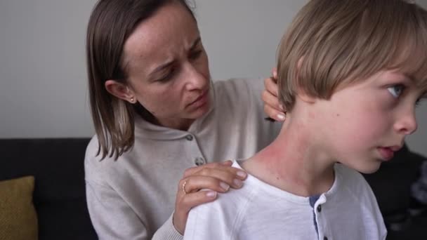 Objawy zapalenia skóry. Mama zauważyła wysypkę na szyi chłopców. Niewłaściwe odżywianie. Martwiąca się matka odkrywa wysypkę na ciele dziecka. Ciało, zdrowie. Reakcja alergiczna na światło słoneczne. — Wideo stockowe