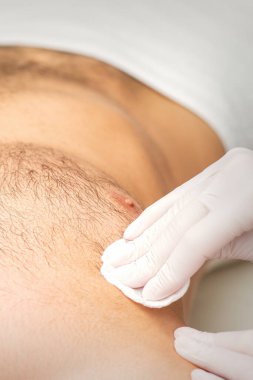 Bir güzellik salonunda göğsünden tüy dökülen beyaz bir adam, erkek gövdesi tüy döküyor.