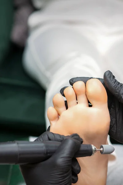 Kadın Ayağının Nasırından Ayak Tabanında Pedikür Ameliyatı Güzellik Salonunda Pedikür — Stok fotoğraf