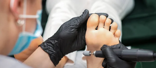 Peeling Pedikyr Förfarande Sulan Från Kallus Den Kvinnliga Foten Pedicurist — Stockfoto