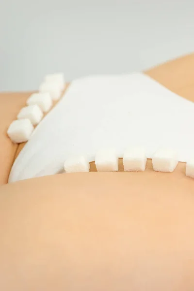 Kostky Cukru Ležící Řadě Ženské Bikini Zóně Koncept Intimní Depilace — Stock fotografie