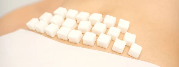 Epilasyon Ağda Yakın Hijyen Kavramı Şeker Küpleri Genç Beyaz Bir — Stok fotoğraf