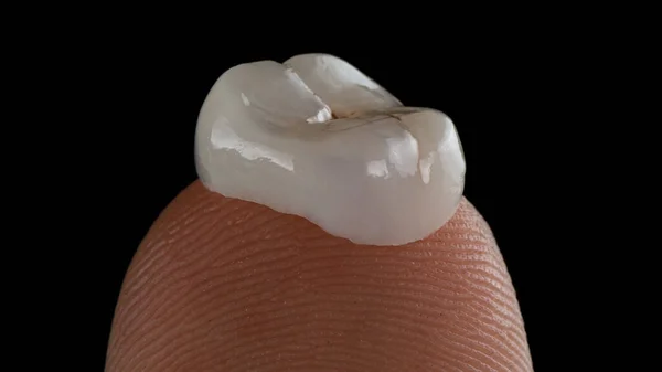 Dental crown of ceramics on factor finger
