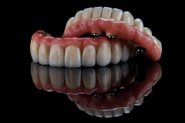 Bela Cerâmica Dentária Próteses Titan Composição Vidro Preto Com Reflexão — Fotografia de Stock