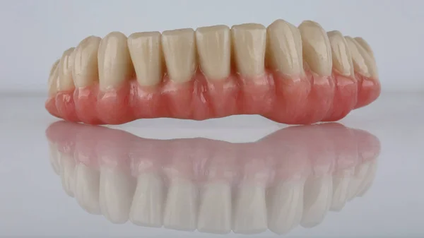Dental Prótese Maxilar Inferior Com Cúpulas Cor Rosa Fundo Branco — Fotografia de Stock