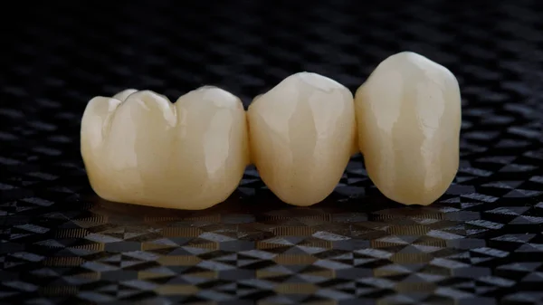 Hermosas Coronas Circón Dental Sobre Fondo Texturizado —  Fotos de Stock