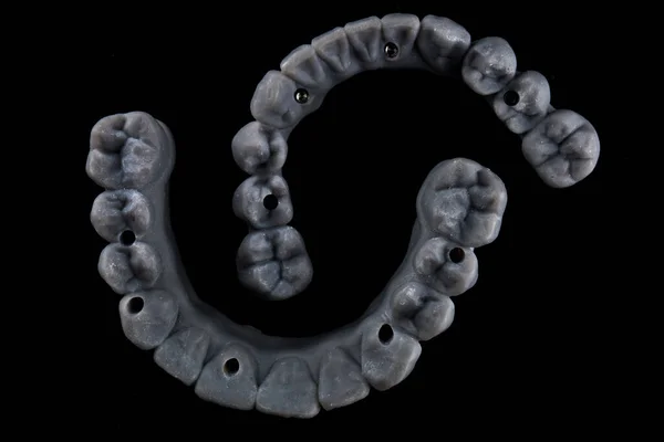 プロパティ義歯ステージのための歯科用義歯 黒の背景にトップビュー — ストック写真