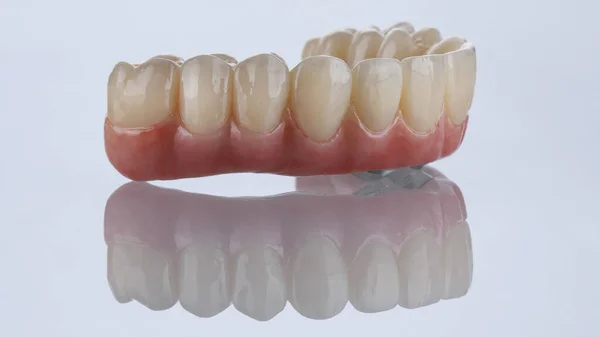 Excelente Prótesis Dental Sobre Fondo Blanco Con Reflexión Creativa — Foto de Stock