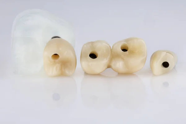 Coroas Dentárias Temporárias Dentes Mastigando Fundo Branco — Fotografia de Stock