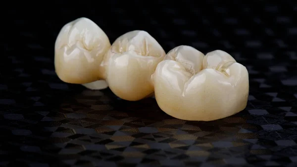 Three Ceramic Dental Crowns Form Bridge Chewing Teeth — Stock Photo, Image
