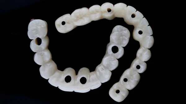 Composição Próteses Dentárias Temporárias Para Mandíbulas Inferior Superior Vista Superior — Fotografia de Stock