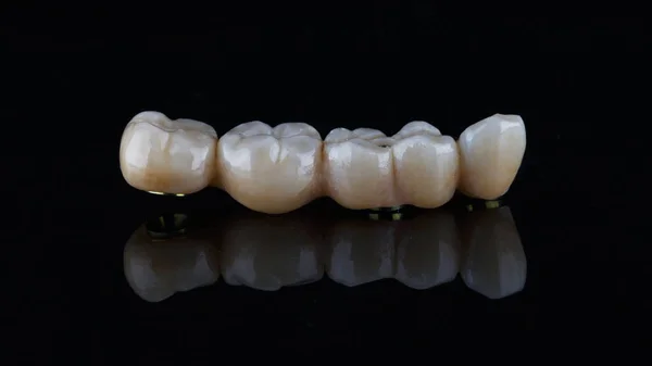 Zdjęcie Dentystyczne Mostu Cyrkonowego Czarnym Tle — Zdjęcie stockowe