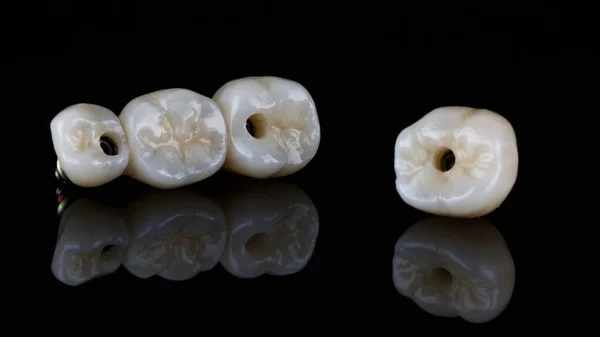 Zubní Můstek Koruna Vysoké Kvality Černém Skle Odrazem — Stock fotografie