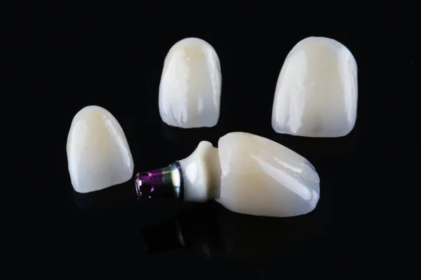 Beautifully Laid Out High Quality Dental Crowns Made Ceramic Black — Stock Photo, Image