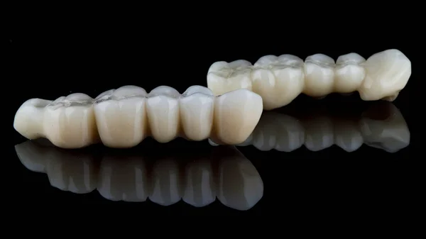 Diş Protezleri Hastanın Çenesinin Çiğneme Kısmının Yenilenmesi Için Köprüler Yansıma — Stok fotoğraf