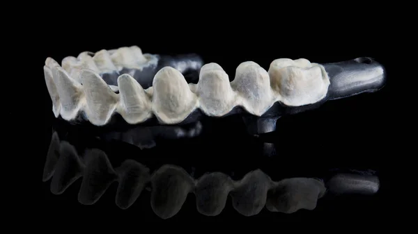 Haz Titanio Mandíbula Superior Material Especial Para Coronas Dentales Vista — Foto de Stock