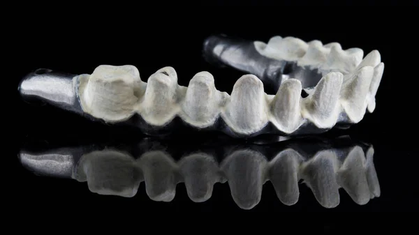 Upper Jaw Titanium Beam Dental Crowns Side View Shot Black — Stock Photo, Image