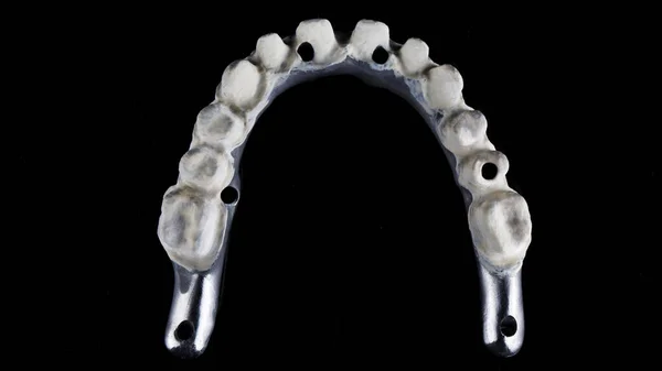 Diş Kaplamaları Için Yüksek Kaliteli Titanyum Üst Çene Appaka Dan — Stok fotoğraf