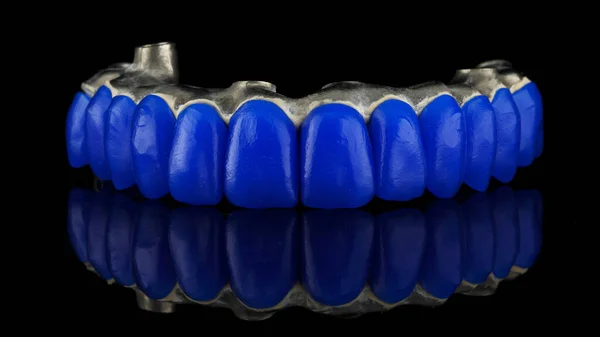 Makro Zdjęcie Dentystycznej Wiązki Tytanu Niebieskimi Zębami Wosku Aby Przymierzyć — Zdjęcie stockowe
