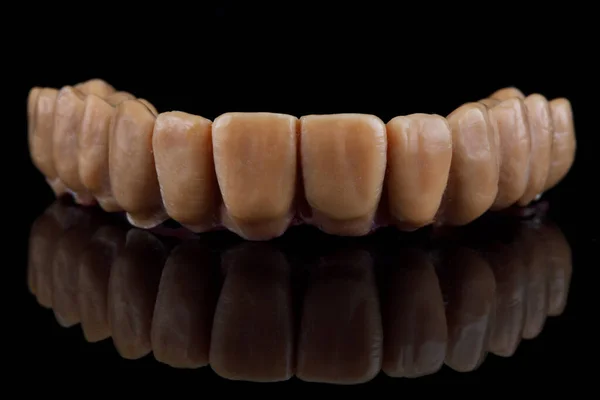 Бежевый Искусственный Зуб Верхней Челюсти Черном Отражением — стоковое фото