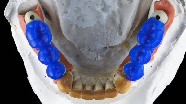 Dasar Gigi Dan Gigi Lilin Biru Untuk Menyesuaikan Diri Dalam — Stok Foto