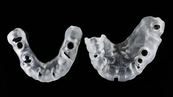 Diş Cerrahisi Şablonu Siyah Arkaplanda Üst Görünüm — Stok fotoğraf