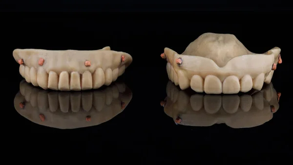 反射して黒ガラス上の下顎と上顎のためのマーカーと歯科スキャン入れ歯 — ストック写真