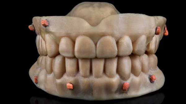 下顎と上顎のための特別なマーカーを持つ歯科用義歯は 反射して黒の背景にかむ — ストック写真