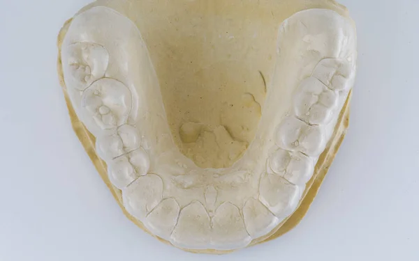 Tampão Dental Para Plástico Das Gengivas Mandíbula Superior Sobre Fundo — Fotografia de Stock