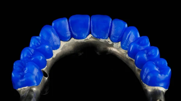 上顎の青いワックスから歯科用義歯を製造する準備をしました 内側から黒い背景で見ると — ストック写真
