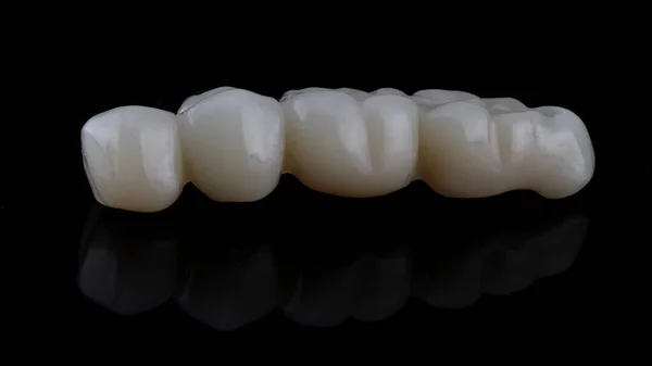 Mostek Dentystyczny Mała Proteza Wszczepieniu Części Żującej Szczęki Czarnym Tle — Zdjęcie stockowe