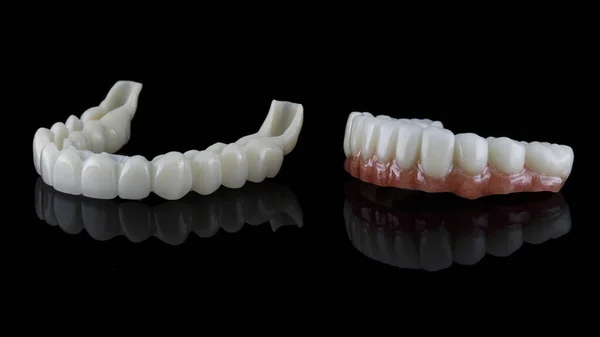 Composición Dos Prótesis Dentales Temporales Para Mandíbula Inferior Superior Sobre —  Fotos de Stock