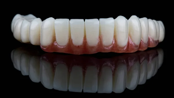 High Quality Lower Jaw Prosthesis Pink Gum Black Background — Stock Photo, Image